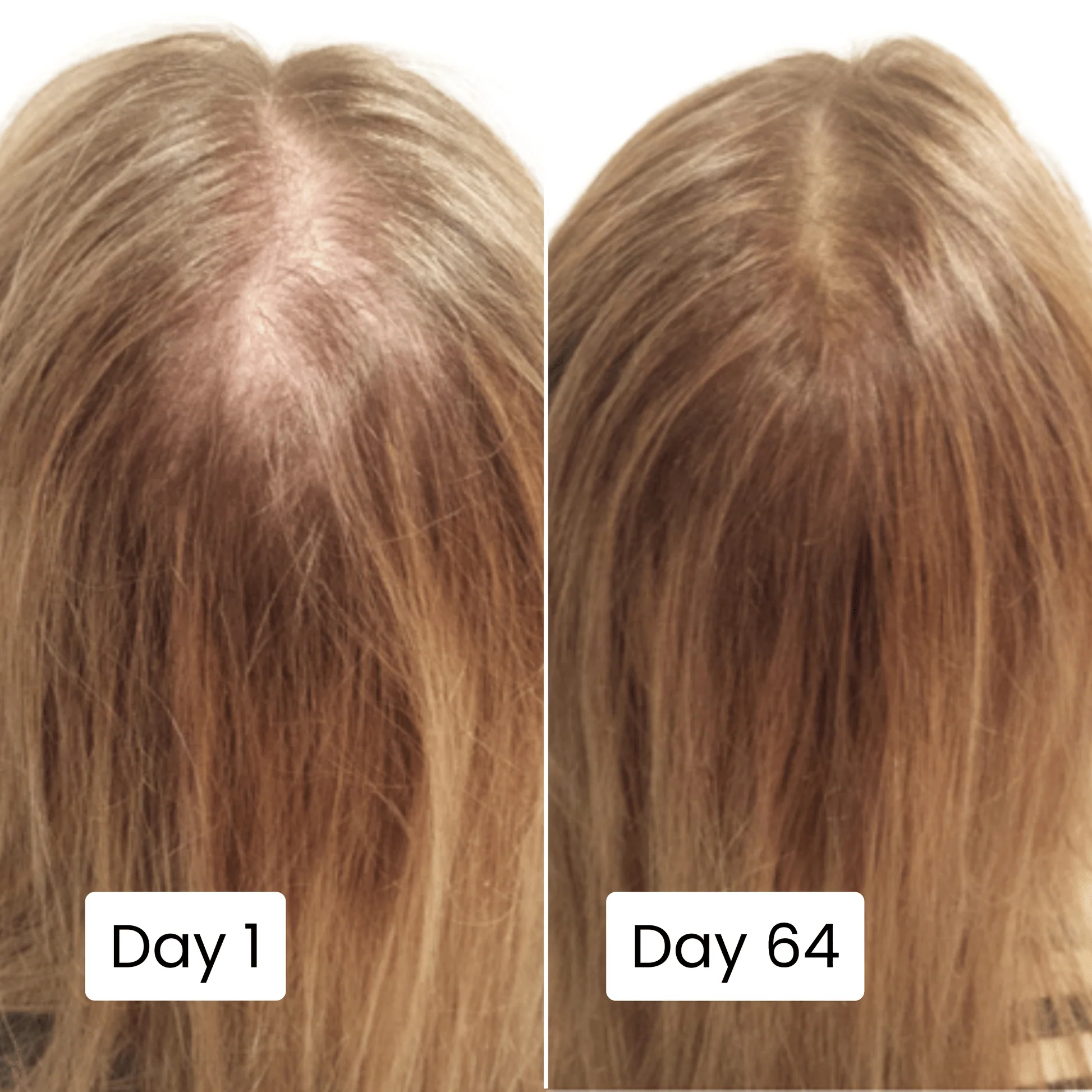 Scalpy Hair Growth Serum Original Limited Time Deal With Free Home Delivery All Over Uae
