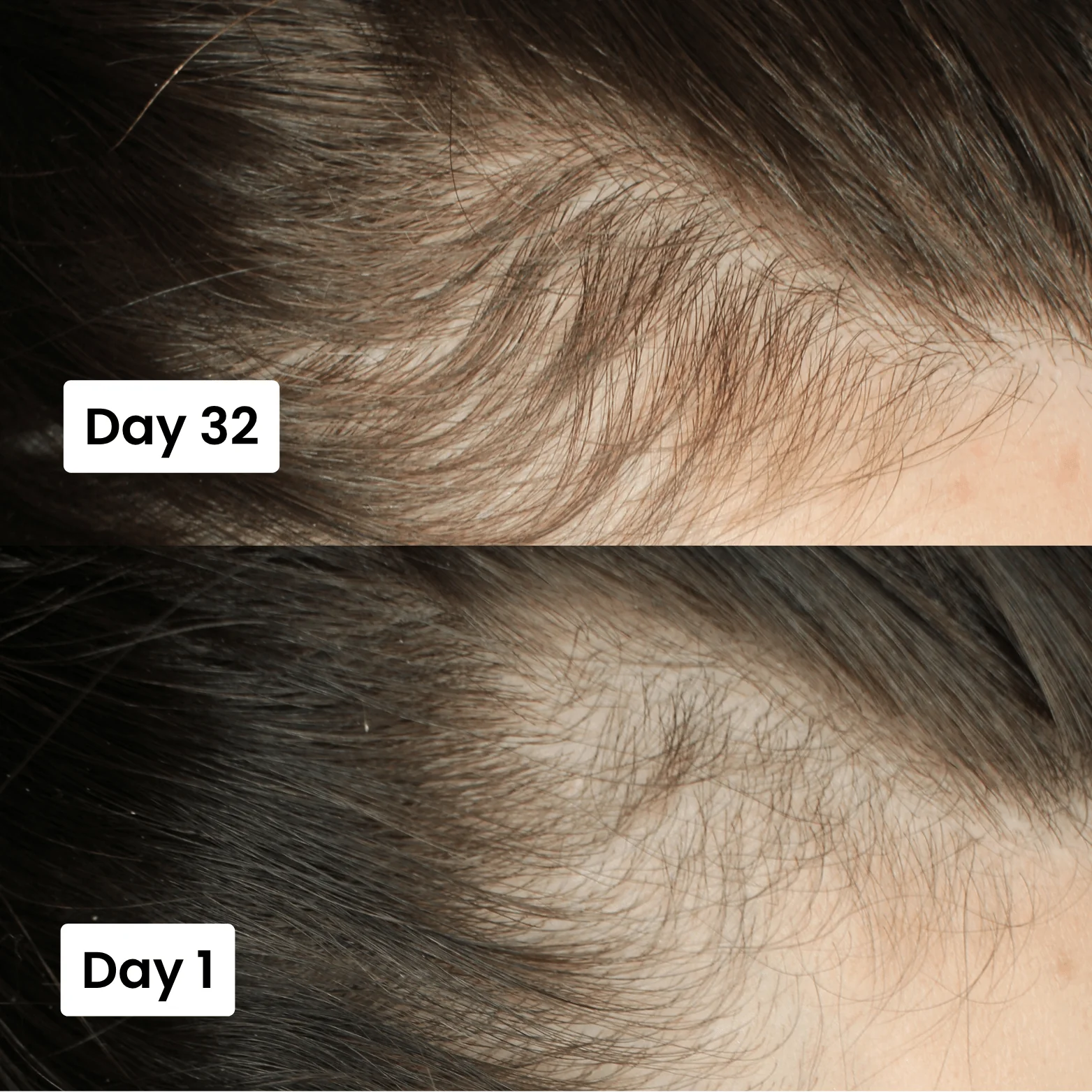 Scalpy Hair Growth Serum Original Limited Time Deal With Free Home Delivery All Over Uae